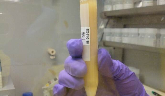 Substanz aus dem Behälter mit der Aufschrift "Polonium 210"