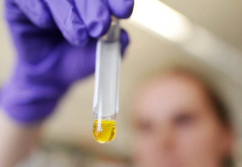 Laut dem Landesgesundheitsamt gab es 2019 in Baden-Württemberg wieder vermehrt Fälle von Hanta-Virus.