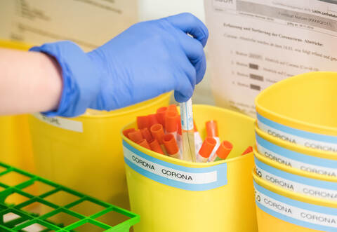 In Pforzheim gab es am Freitag nur zwei neue Corona-Fälle.