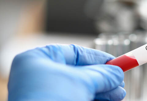 Das Gesundheitsamt habe die Unterkünfte für insgesamt 400 Mitarbeiter in Bad Wildbad, Höfen und Schömberg überprüft und zielführende Verordnungen seien erlassen worden, informierte Landrat Riegger.