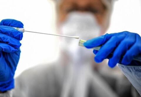 Die meisten Infizierten (knapp 1,8 Millionen) und Todesfälle (über 100.000) in der Corona-Pandemie verzeichneten zuletzt