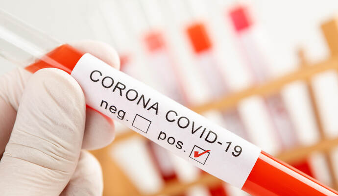 Mehrere Mitarbeiter einer Firma aus Mühlacker sind positiv auf das Coronavirus getestet worden. Mehrere Mitarbeiter einer Firma aus Mühlacker sind positiv auf das Coronavirus getestet worden.