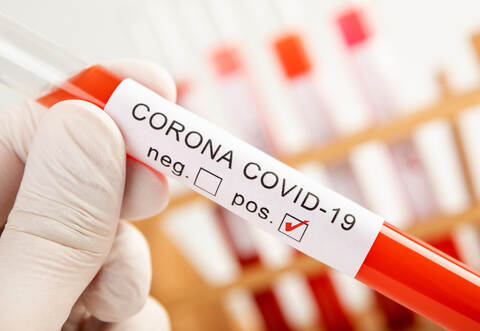 Mehrere Mitarbeiter einer Firma aus Mühlacker sind positiv auf das Coronavirus getestet worden.